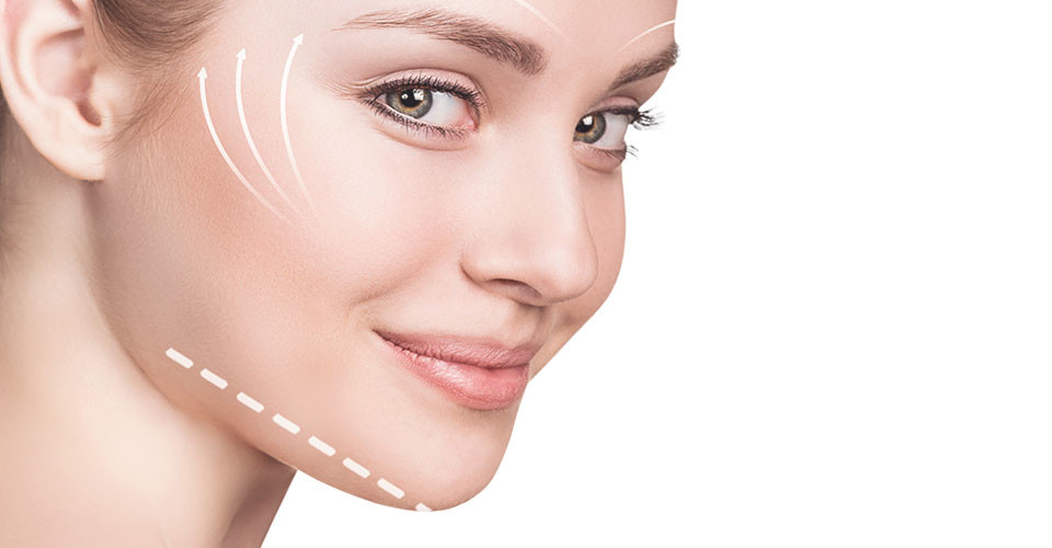 Thread Lift